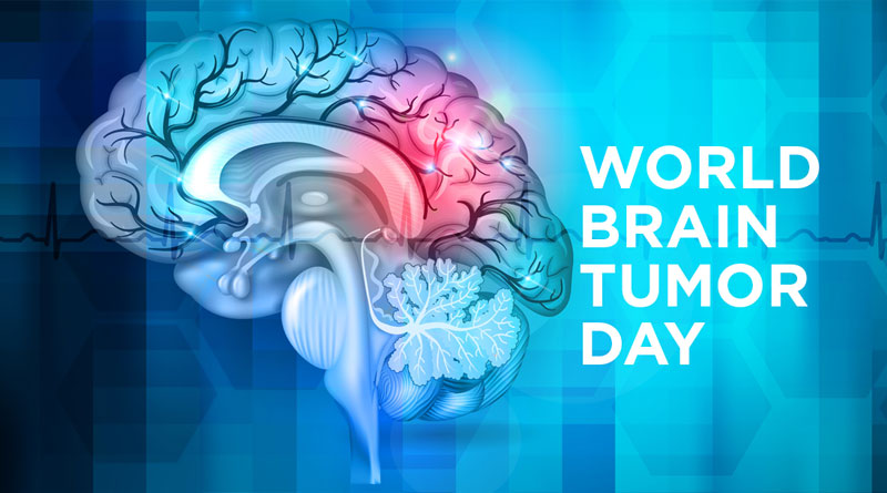 World Brain Tumor Day 2020 Here Are The Types Causes Symptoms